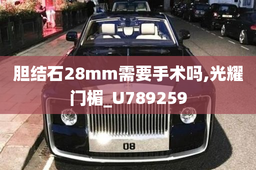 胆结石28mm需要手术吗,光耀门楣_U789259